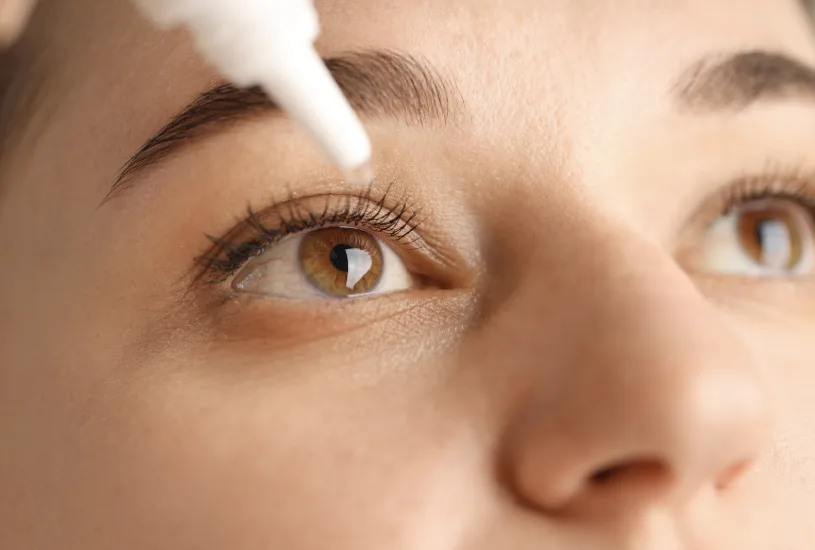 Eine Nahaufnahme einer Frau, die Augentropfen in einem hellen, modernen Schweizer Zuhause anwendet, mit einem fokussierten Blick auf das Fläschchen und das Auge.
