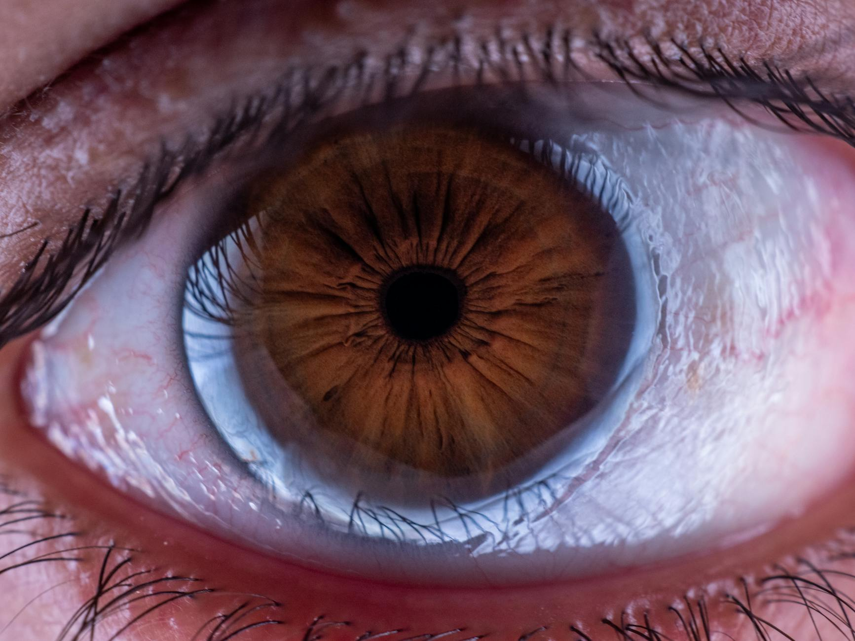 Eine Nahaufnahme einer Frau, die Augentropfen in einem hellen, modernen Schweizer Zuhause anwendet, mit einem fokussierten Blick auf das Fläschchen und das Auge.